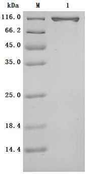 SDS-PAGE
