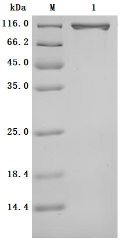 SDS-PAGE