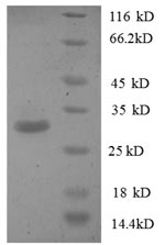 SDS-PAGE