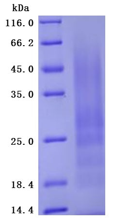 SDS-PAGE