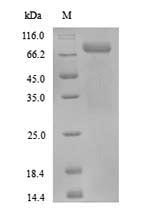 SDS-PAGE