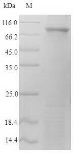 SDS-PAGE
