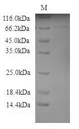 SDS-PAGE