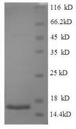 SDS-PAGE