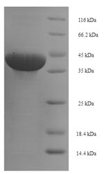 SDS-PAGE