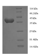 SDS-PAGE