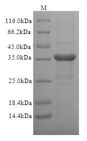 SDS-PAGE