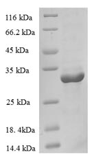 SDS-PAGE