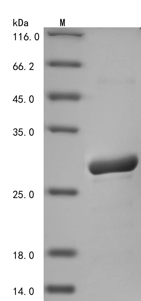 SDS-PAGE