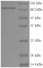 SDS-PAGE