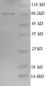 SDS-PAGE