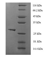 SDS-PAGE