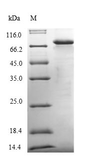 SDS-PAGE