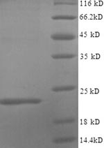 SDS-PAGE