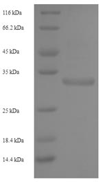SDS-PAGE