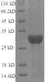 SDS-PAGE