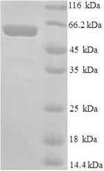 SDS-PAGE
