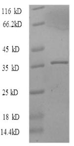SDS-PAGE