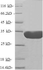 SDS-PAGE