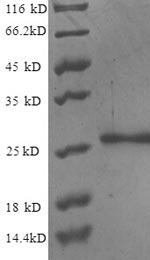SDS-PAGE