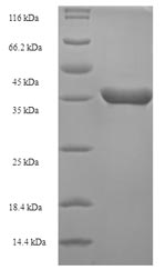 SDS-PAGE