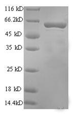 SDS-PAGE
