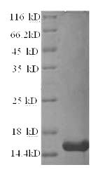 SDS-PAGE