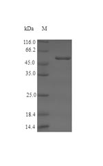 SDS-PAGE