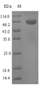 SDS-PAGE
