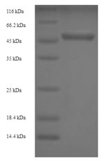 SDS-PAGE