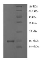 SDS-PAGE