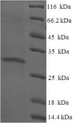 SDS-PAGE