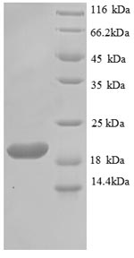 SDS-PAGE