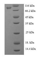 SDS-PAGE