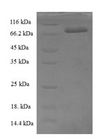 SDS-PAGE