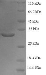SDS-PAGE