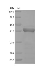 SDS-PAGE
