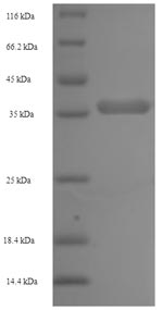 SDS-PAGE