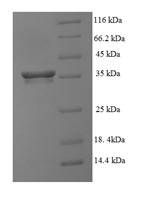 SDS-PAGE