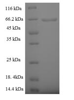 SDS-PAGE