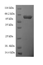 SDS-PAGE