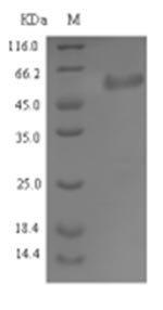 SDS-PAGE