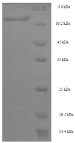 SDS-PAGE