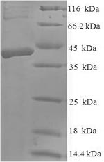 SDS-PAGE