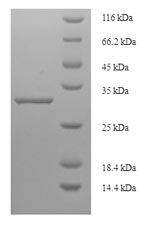 SDS-PAGE