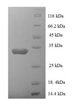 SDS-PAGE