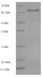 SDS-PAGE