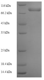 SDS-PAGE