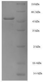 SDS-PAGE