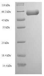 SDS-PAGE